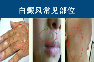 ���糣����λ