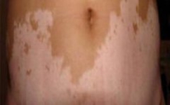 ר�ҽ�������Σ������Щ