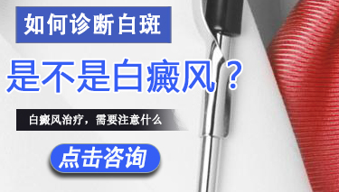 诊断白癜风疾病有哪些方法 如何诊断白斑是不是白癜风.jpg