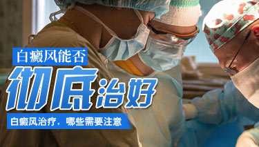 白斑不扩散会不会是治愈的症状 8.18 (无)白癜疯能彻底治好吗.jpg