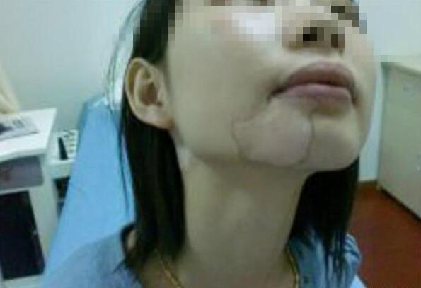 武汉白可以帅海林