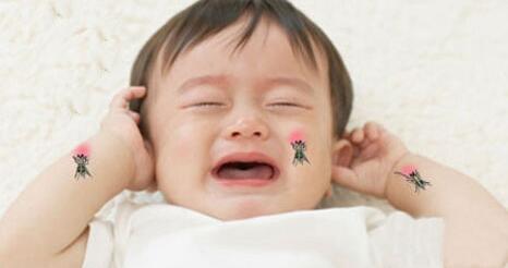 宝宝手上出现白癜风要怎么治