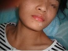 武汉小孩白癜风能治好吗