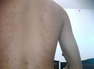 武汉白癜风该怎么治才好?