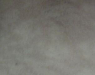 武汉白癜风治疗的关键在于方法