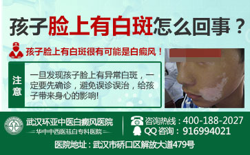 白癜风的初始症状有哪些 白癜风的初始症状有哪些