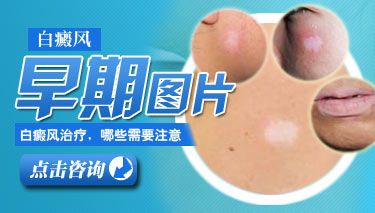 儿童白癜风有哪些常见的症状 8.22 白癜风早期图片.jpg