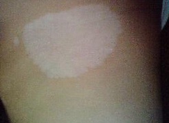 �人����֢״��������Щ