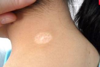 �人�ĸ�ҽԺ�������ƶ�ͯ����