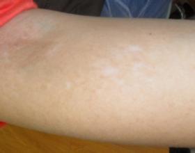 武汉白颠特临环亚