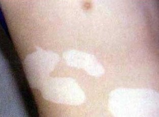 武汉医院白环亚定行