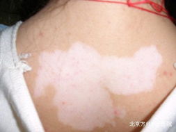 �人Ů���аװ�Ӧ���������